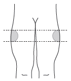 Schema di due ossa pelviche con linea tratteggiata orizzontale e verticale e punto di iniezione indicato