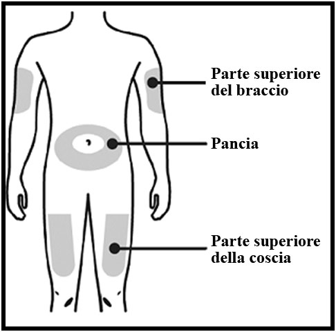 Schema del corpo umano con indicazioni delle aree di iniezione sottocutanea braccia pancia e cosce frecce puntano le zone