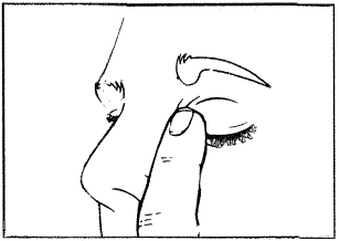 Profilo del viso con occhio e palpebra inferiore abbassata per applicare gocce oculari