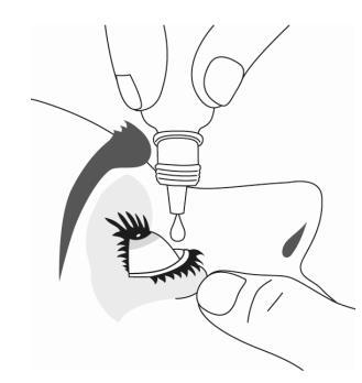 Applicazione di collirio con contagocce in mano che avvicina il flacone all