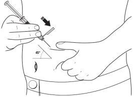Mano sujetando jeringa con aguja insertada en piel a 45 grados flecha indica dirección de inserción cintura visible con pantalón