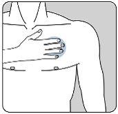Hand pinching the skin of the upper arm forming a fold for intramuscular injection